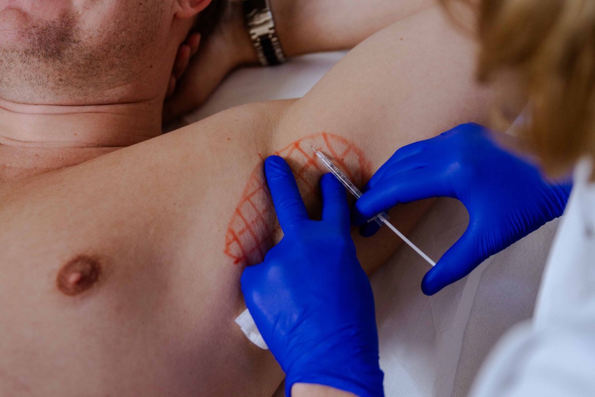 Medische botox behandeling Den Bosch Clinique Pure - 1 Medische botox in Den Bosch bij Clinique Pure